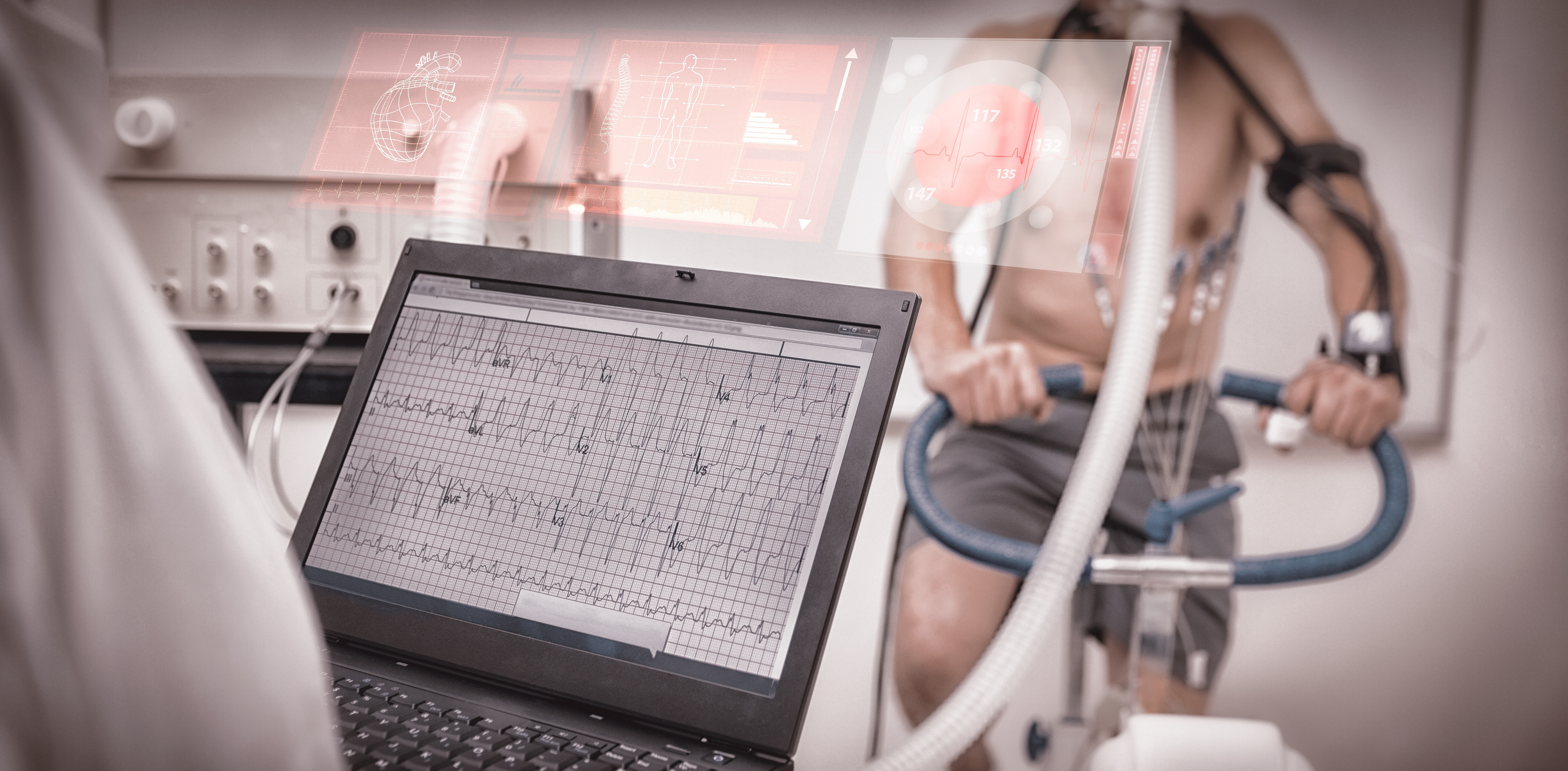 What is a Stress Test and Why is it Done Pulse Cardiology